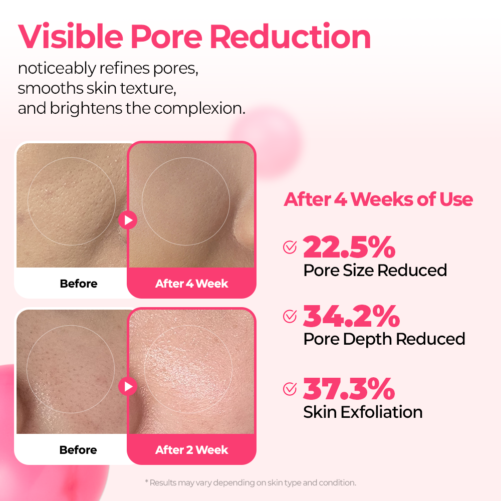 Cemenrete Cyano Pink Spicule Serum - image 8