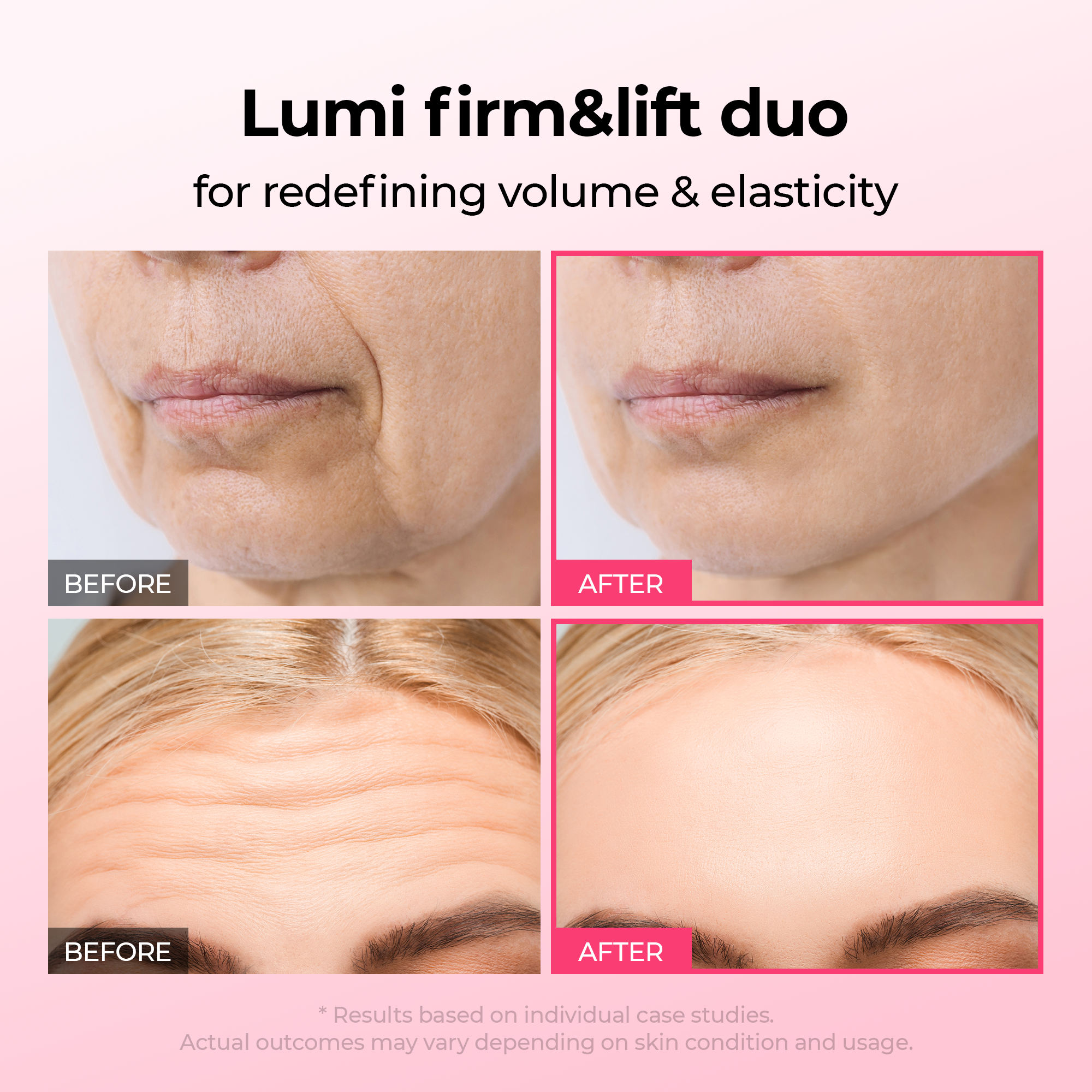 [TikTok Bestseller] Lumi firm & lift Duo - image 2